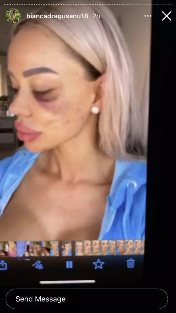 Bianca-Dragusanu-batuta-8-576x1024