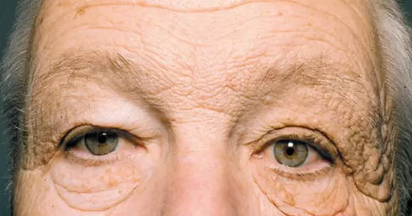 Cum arată faţa unui șofer de camion după 28 de ani de expunere la soare