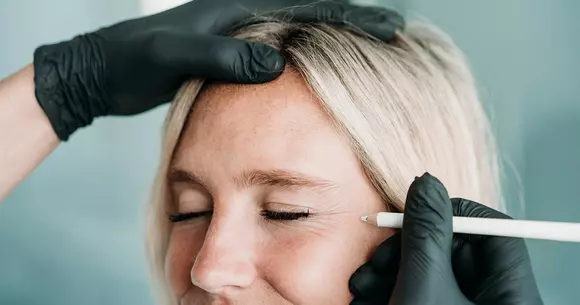 (P) Injectarea cu botox în zona frunții și tot ce trebuie să știm despre procedură