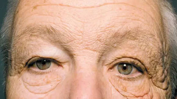 Cum arată faţa unui șofer de camion după 28 de ani de expunere la soare