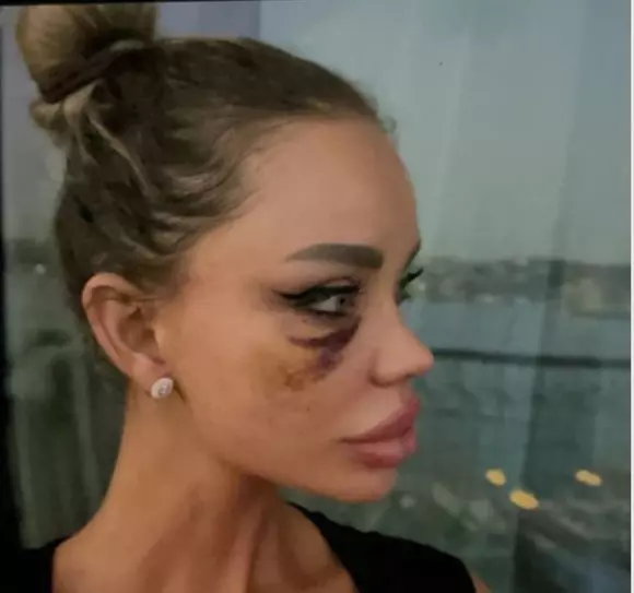 b399c3c89f03fcaaf2e464d017e7bf3f