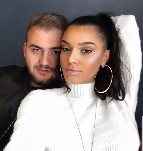 Karmen-prima-intervenție-estetică-10