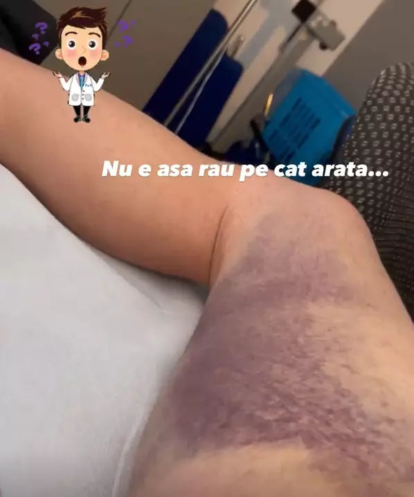 Tavi Clonda probleme de sănătate