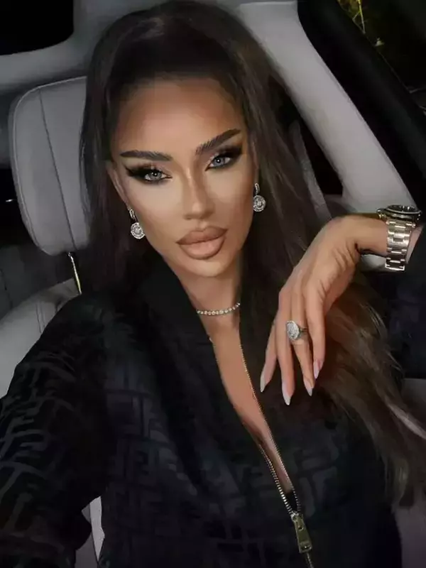 bianca-dragusanu-operatii-estetice-2