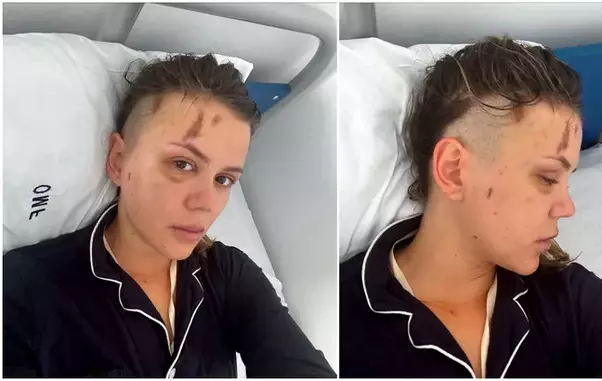 emily-burghelea-inainte-de-prima-operatie-1