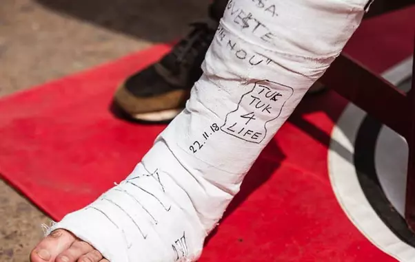 Oase s-a ales cu piciorul in gips la Asia Express