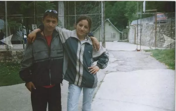 Ruby înainte de operațiile estetice