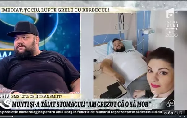 Munti operație stomac