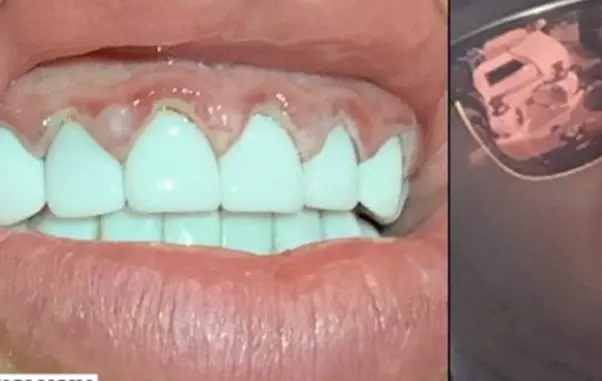 Raluca Podea, probleme cu dantura