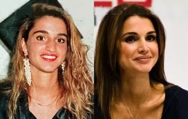 Regina Rania a Iordaniei, atunci și acum. Operația de rinoplastie e vizibilă, la fel și buzele mai pline și lipsa ridurilor de expresie.