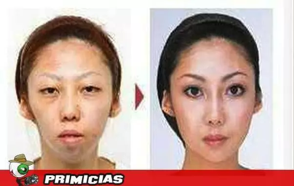 Sotia înainte și după operațiile estetice