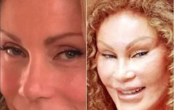 Jocelyn Wildenstein a fost o femeie drăguță.