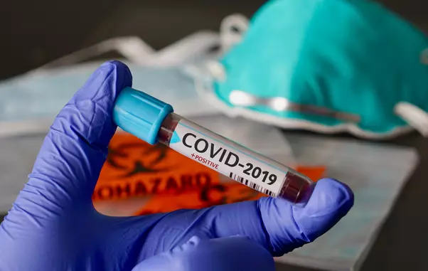 Coronavirus-COVID-19-nCoV-2019-23-of-23-15