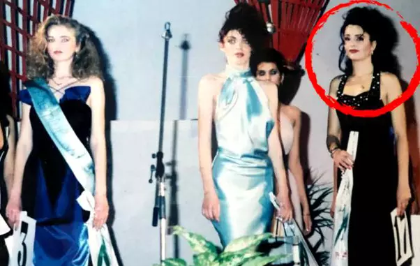 Brigitte-Nastase-operatii-estetice-2