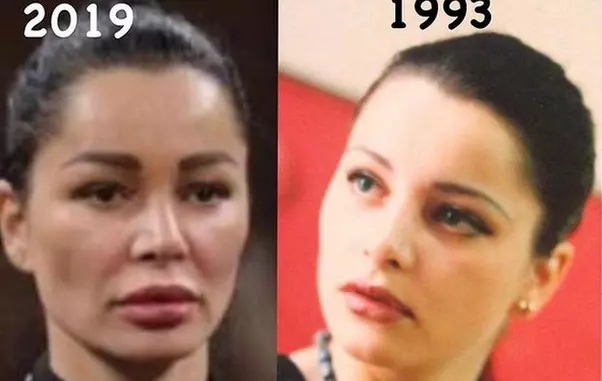 Brigitte-operatii-estetice-1