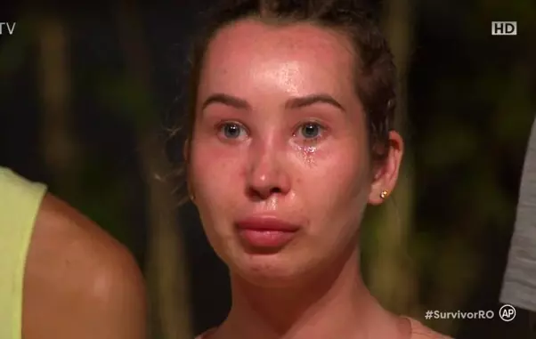 Xonia cu fata umflata