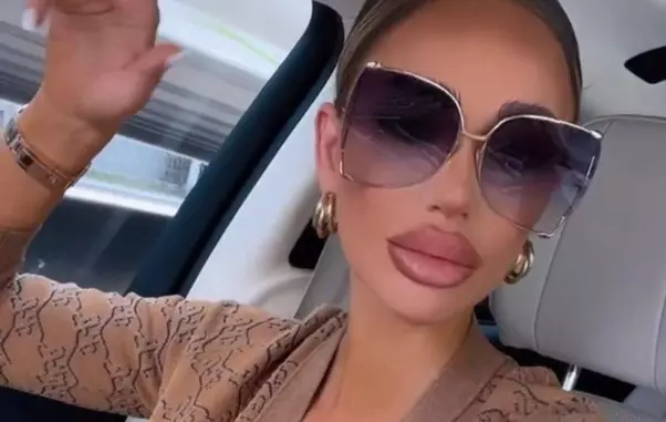 bianca dragusanu si-a schimbat forma buzelor