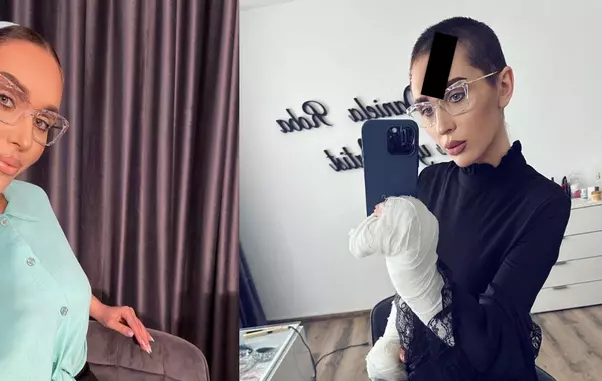 dana-roba-acuzata-ca-cerseste-dupa-ce-a-cerut-bani-pentru-operatiile-de-care-are-nevoie-make-up-artista-vrea-sa-si-faca-operatie-de-reconstructie-a-mainilor-1
