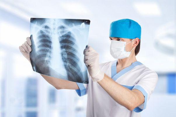 Fibroza Pulmonară Idiopatică Poate Ucide In Tăcere