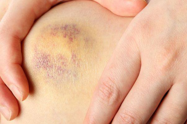 15 Simptome Ale Cancerului Pe Care Femeile Au Tendința Să Le Ignore