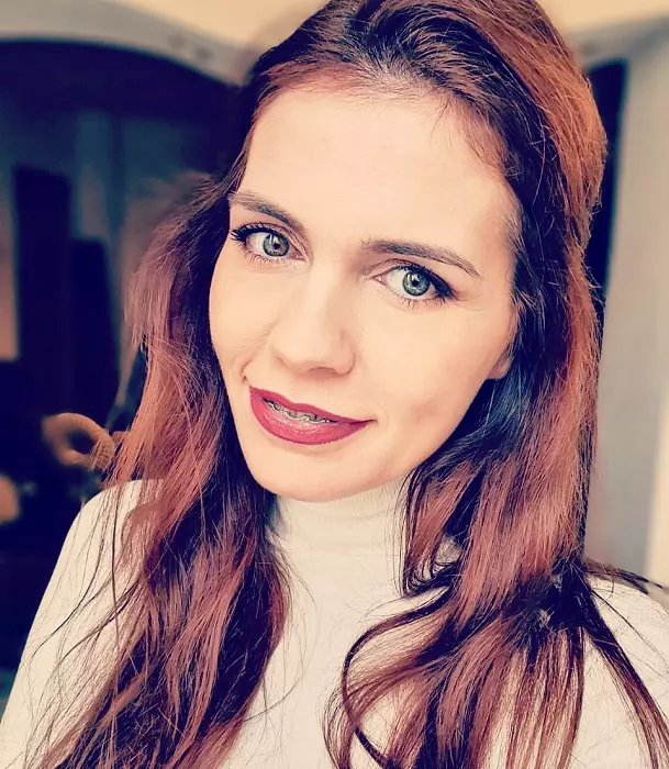 aida parascan 2