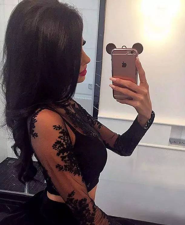 Justyna-operatii-estetice-6