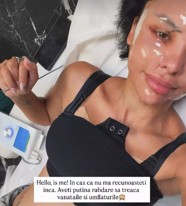 andreea popescu cu masca pe fata