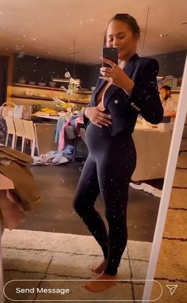 Chrissy Teigen