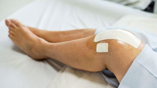 Efuziune în tratamentul articulației genunchiului