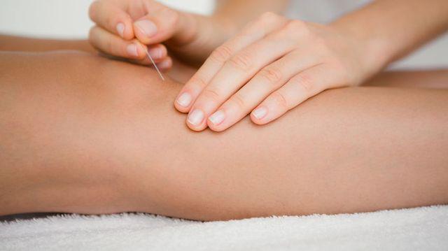 tratamentul prin acupunctură a artrozei genunchiului