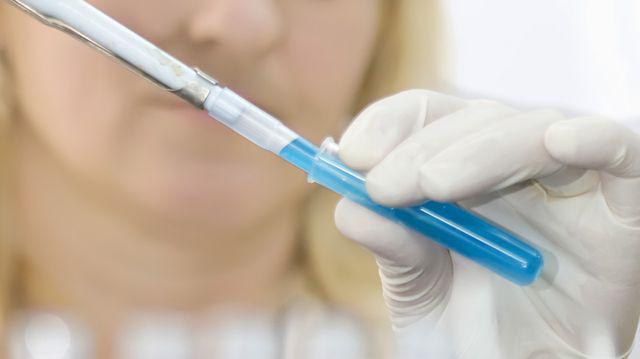 Esofagita De Reflux Simptome și Tratament