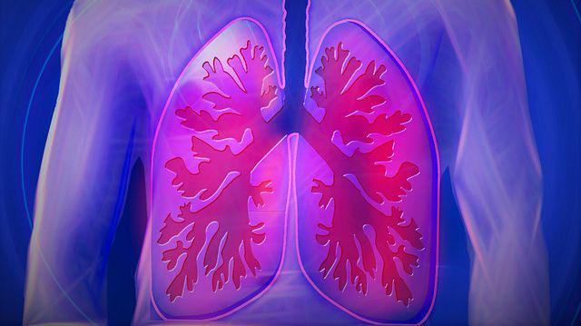 Fibroza Pulmonară Idiopatică Este Greu De Diagnosticat