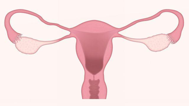 Simptomele Care Pot Anunța Un Fibrom Uterin Iată Ce Trebuie Să știi