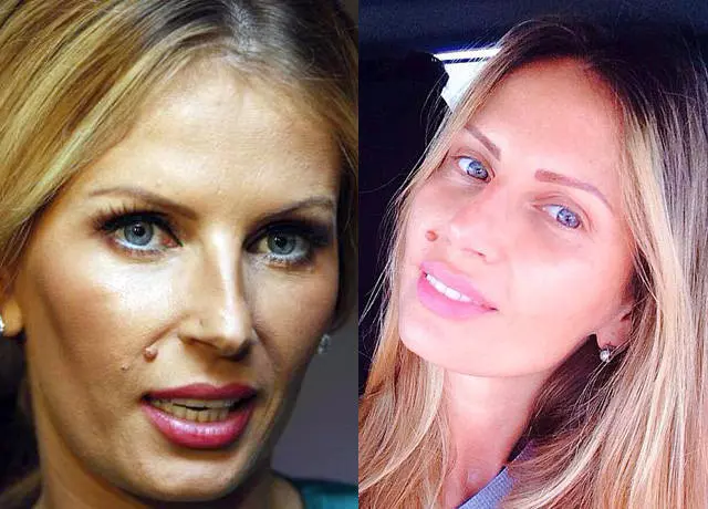 andreea-banica-operatii-estetice