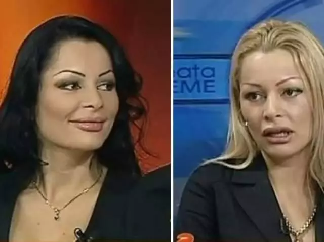Brigitte Pastramă înainte de operațiile estetice (2)