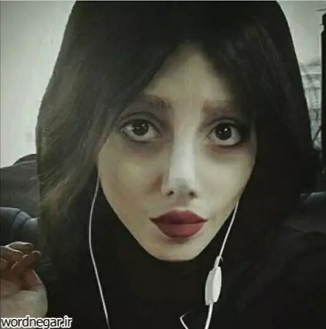 cum-arata-sahar-tabar-inainte-de-cele-50-de-operatii-estetice-9