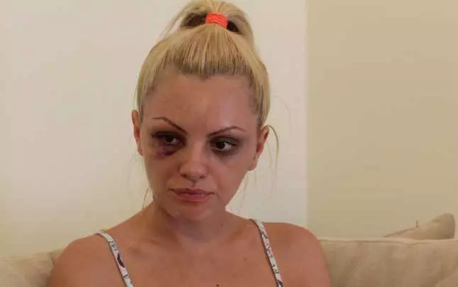 Alexandra Stan survivor bătută de iubit (1)