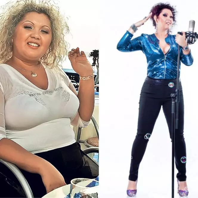 minodora-operatie-stomac-nu-mai-respecta-dieta-medicilor-3-664x664