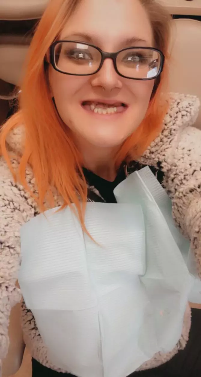 CATFISH WITH DENTURES