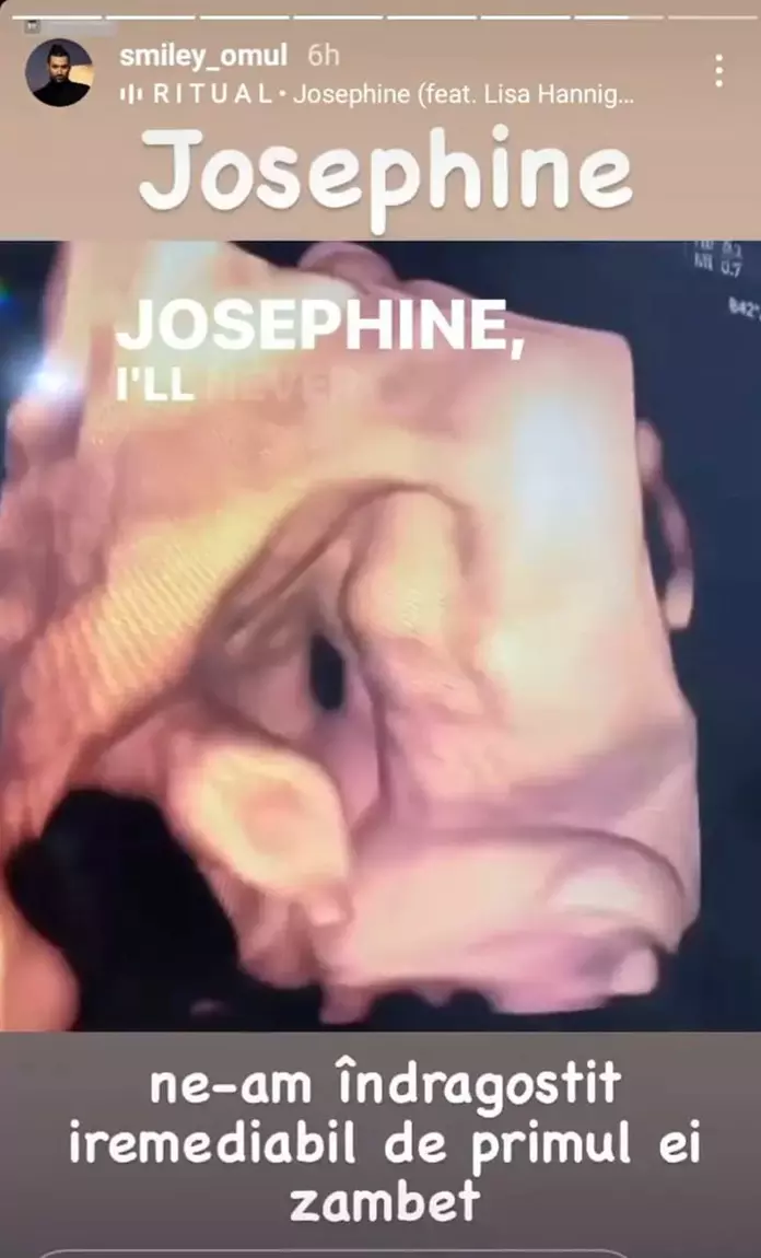 josephine-fetita-smiley-gina