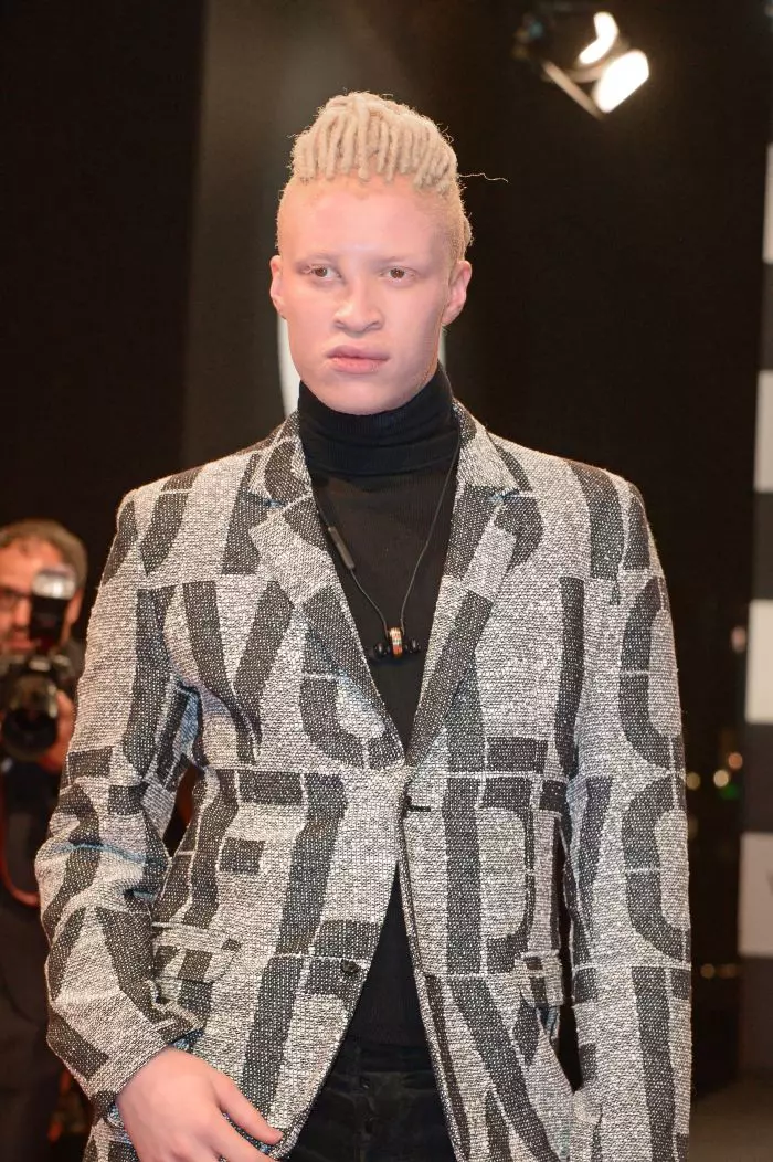 Shaun Ross, un tânăr model de culoare, a fost remarcat tocmai pentru că este albinos.