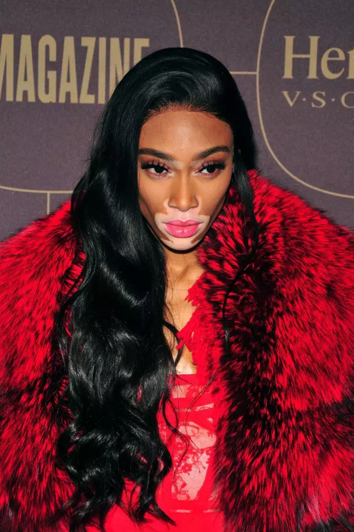 Winnie Harlow, cel mai frumos model cu vitiligo