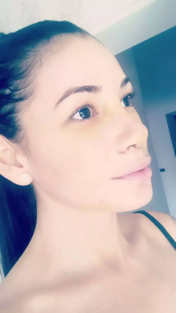 Roxana Vancea, dupa operatia la nas