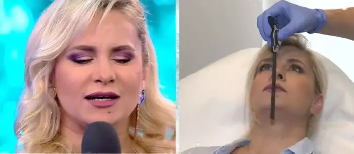 Paula Chirilă, intervenție estetică la nivelul bărbiei
