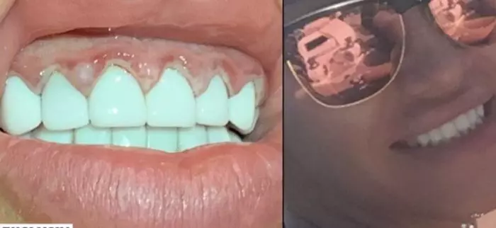 Raluca Podea, probleme cu dantura