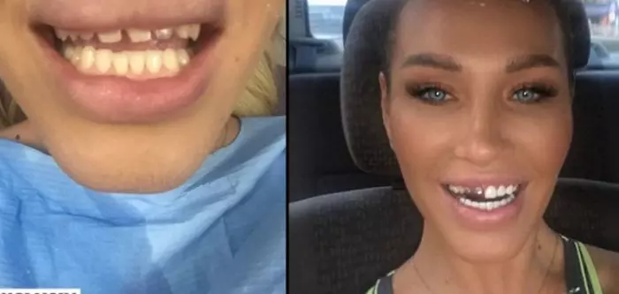 Raluca Podea, probleme cu dantura