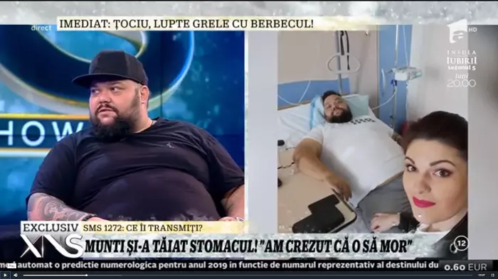 Munti operație stomac