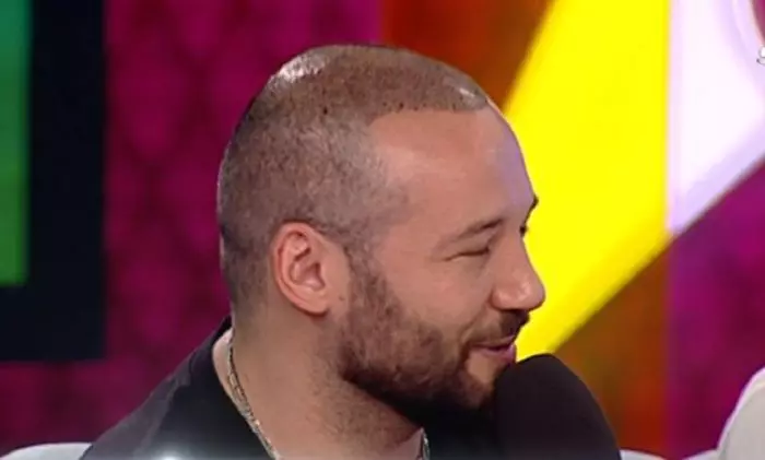 Bogdan, la câteva zile după implantul de păr.