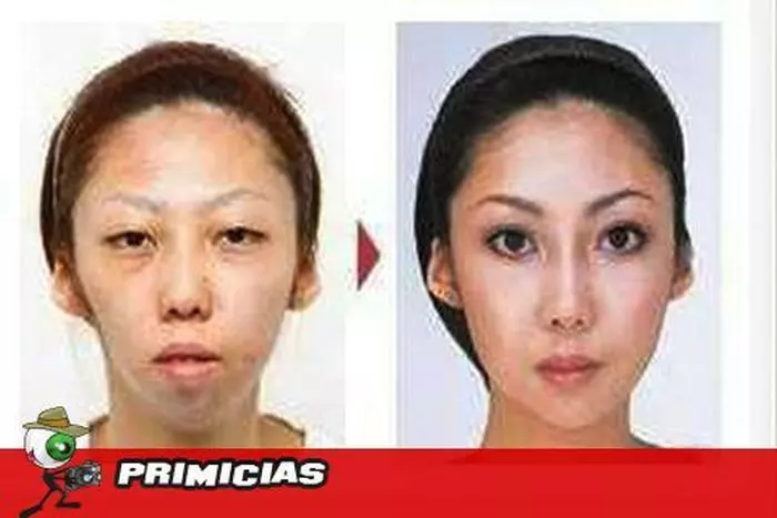 Sotia înainte și după operațiile estetice