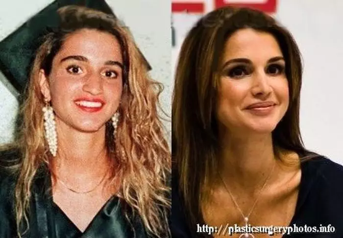 Regina Rania a Iordaniei, atunci și acum. Operația de rinoplastie e vizibilă, la fel și buzele mai pline și lipsa ridurilor de expresie.